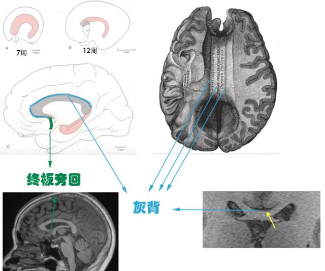 几个小技巧,教你在MRI上轻松识别边缘系统 几个小技巧,教你在MRI上轻松识别边缘系统