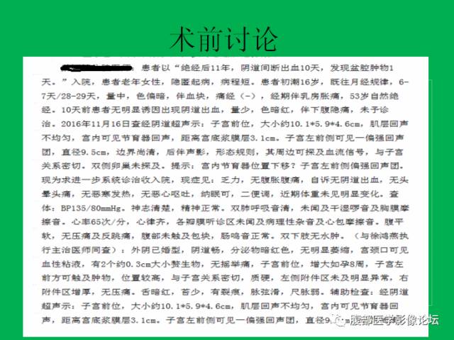 【病例】子宫肌瘤伴脂肪样变1例CT