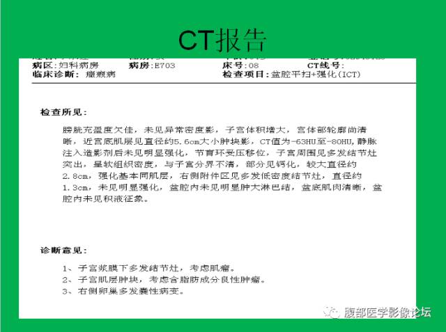 【病例】子宫肌瘤伴脂肪样变1例CT