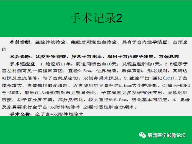 【病例】子宫肌瘤伴脂肪样变1例CT