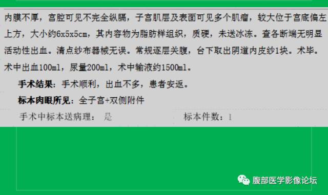 【病例】子宫肌瘤伴脂肪样变1例CT