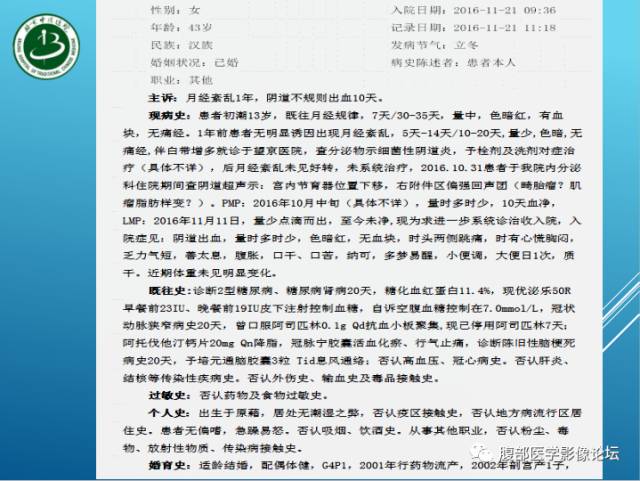 【病例】右侧阔韧带平滑肌瘤脂肪变性1例CT