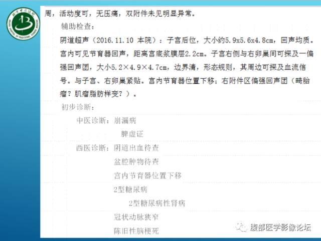 【病例】右侧阔韧带平滑肌瘤脂肪变性1例CT