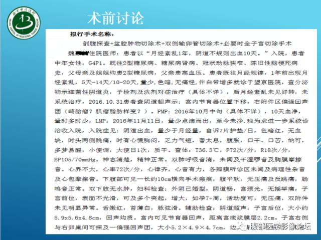 【病例】右侧阔韧带平滑肌瘤脂肪变性1例CT
