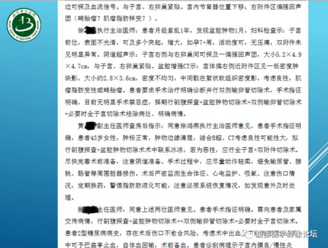 【病例】右侧阔韧带平滑肌瘤脂肪变性1例CT