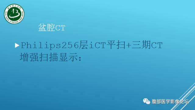 【病例】右侧阔韧带平滑肌瘤脂肪变性1例CT