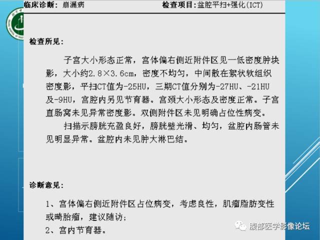 【病例】右侧阔韧带平滑肌瘤脂肪变性1例CT