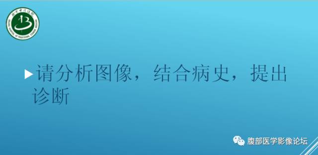 【病例】右侧阔韧带平滑肌瘤脂肪变性1例CT