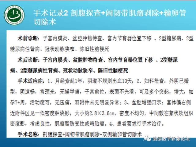 【病例】右侧阔韧带平滑肌瘤脂肪变性1例CT