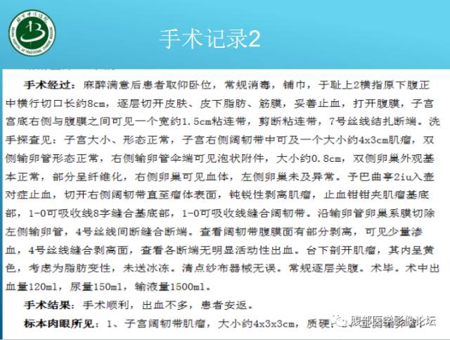 【病例】右侧阔韧带平滑肌瘤脂肪变性1例CT