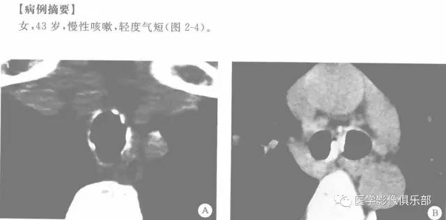 自动草稿