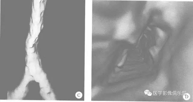 自动草稿