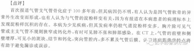自动草稿