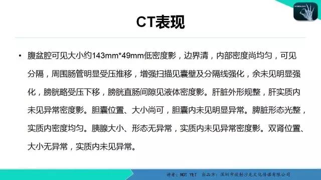 【病例】大网膜淋巴管瘤1例CT影像表现与鉴别