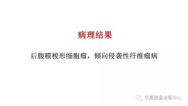 【病例】腹膜后侵袭性纤维瘤病1例CT影像表现