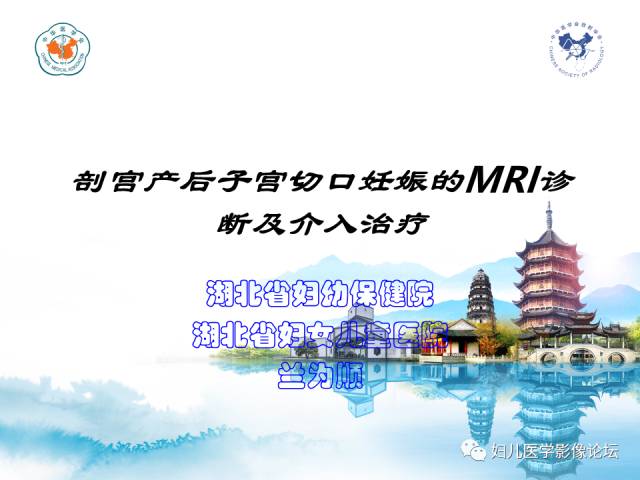 【PPT】剖宫产后子宫切口妊娠的MRI诊断及介入治疗
