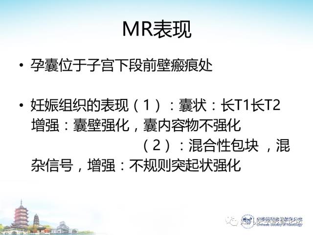 【PPT】剖宫产后子宫切口妊娠的MRI诊断及介入治疗
