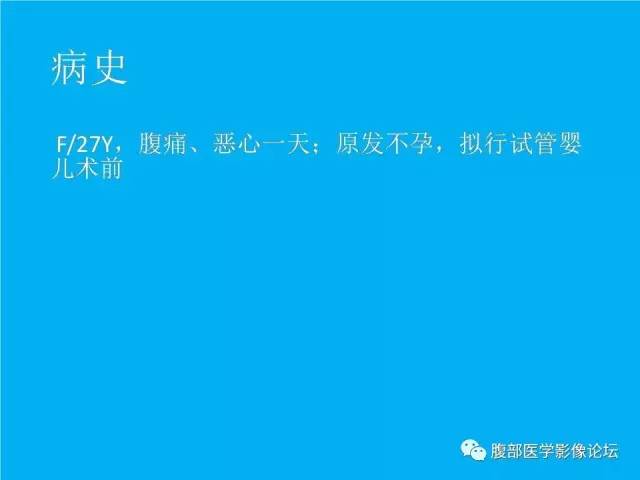【病例】卵巢过度刺激综合征1例CT影像表现