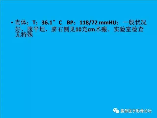 【病例】卵巢过度刺激综合征1例CT影像表现 【病例】卵巢过度刺激综合征1例CT影像表现
