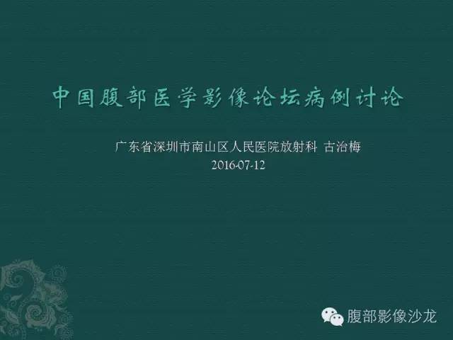 【病例】腹膜后神经鞘瘤1例CT影像表现