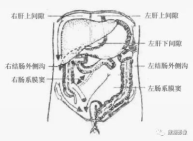 CT腹腔积液常出现在哪几个地方? CT腹腔积液常出现在哪几个地方?