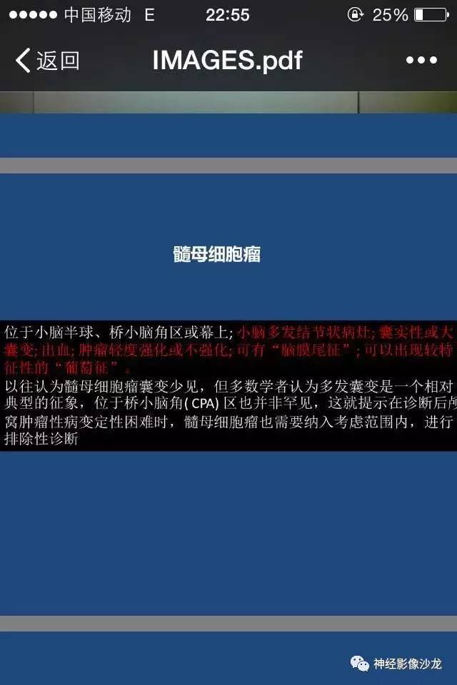 【病例】右顶枕叶髓母细胞瘤一例CT及MR影像讨论 【病例】右顶枕叶髓母细胞瘤一例CT及MR影像讨论