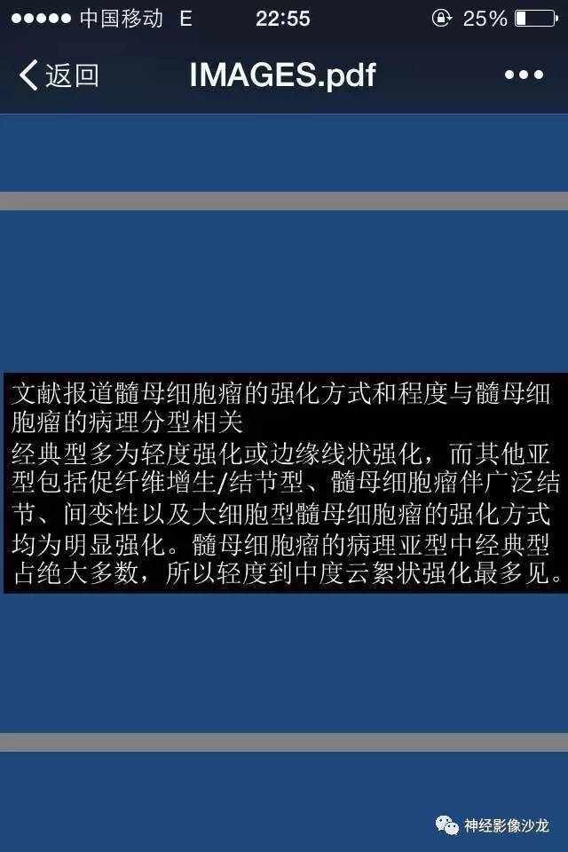 【病例】右顶枕叶髓母细胞瘤一例CT及MR影像讨论 【病例】右顶枕叶髓母细胞瘤一例CT及MR影像讨论