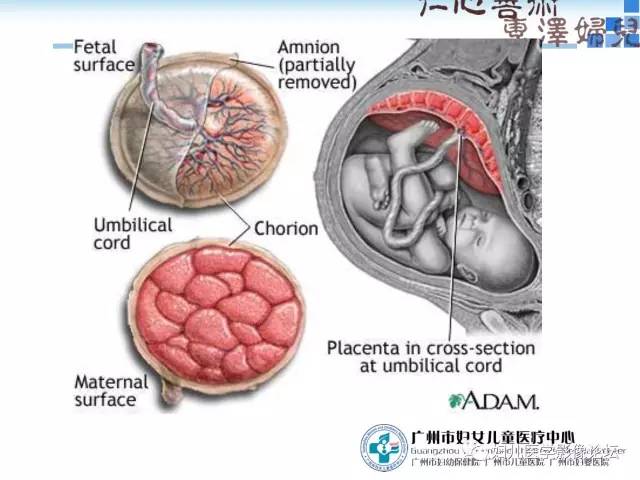 【PPT】产前胎盘植入的MR诊断