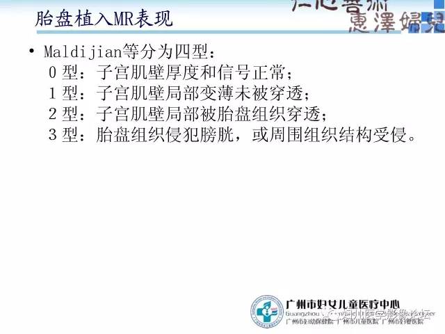 【PPT】产前胎盘植入的MR诊断