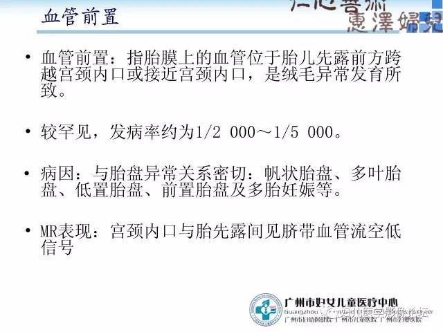 【PPT】产前胎盘植入的MR诊断