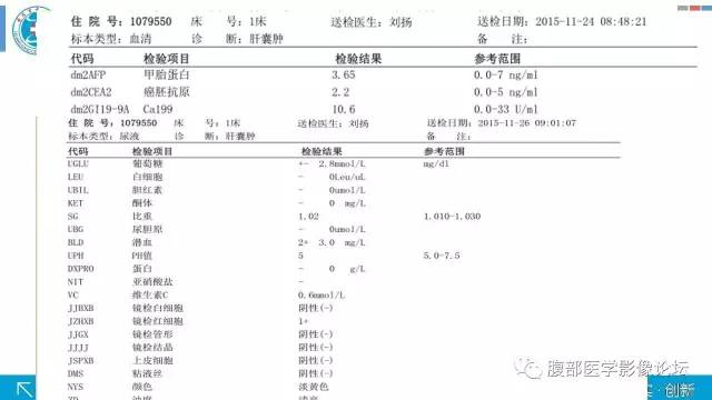 【病例】肾盂癌1例CT及MR影像表现 【病例】肾盂癌1例CT及MR影像表现