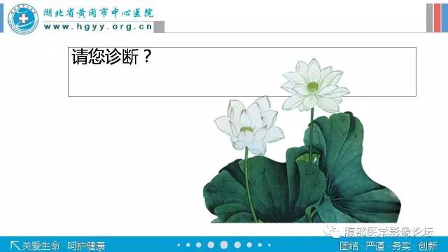 【病例】肾盂癌1例CT及MR影像表现 【病例】肾盂癌1例CT及MR影像表现