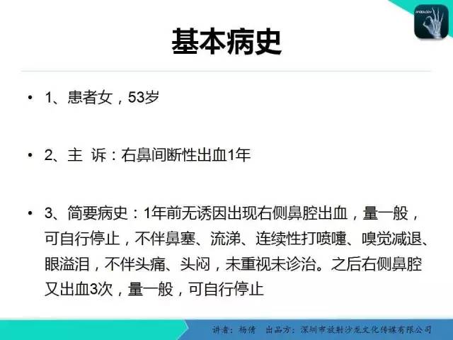 【病例分析】鼻腔血管瘤1例CT影像表现