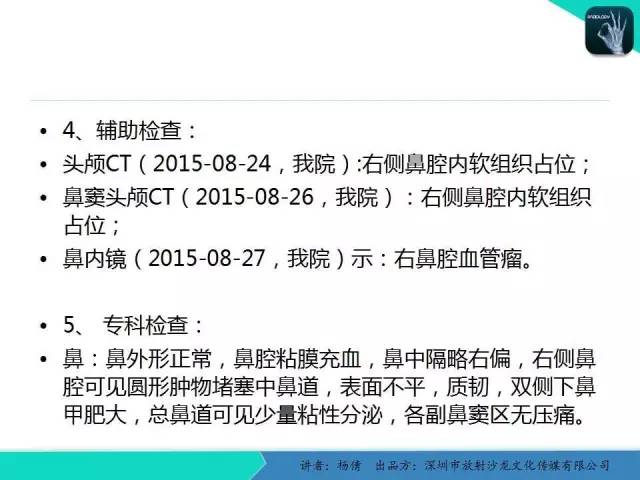 【病例分析】鼻腔血管瘤1例CT影像表现