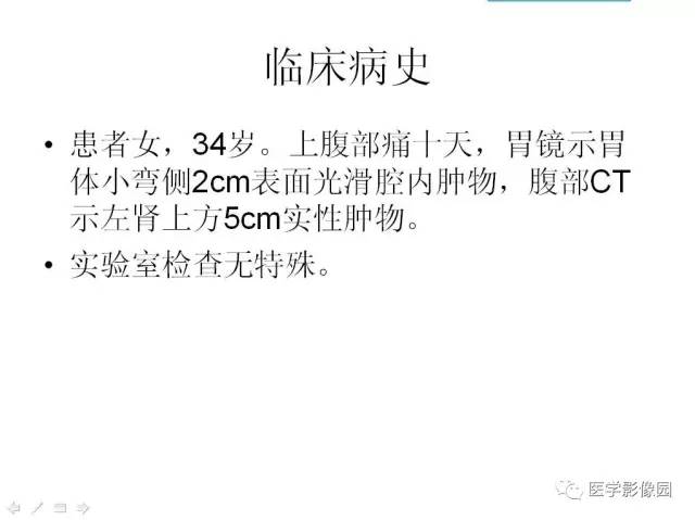 【病例】腹膜后静脉性海绵状血管瘤1例CT影像表现