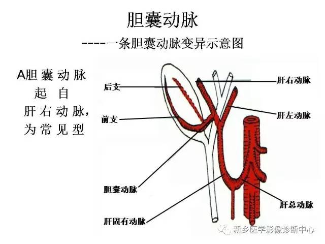 胆囊动脉的解剖和变异