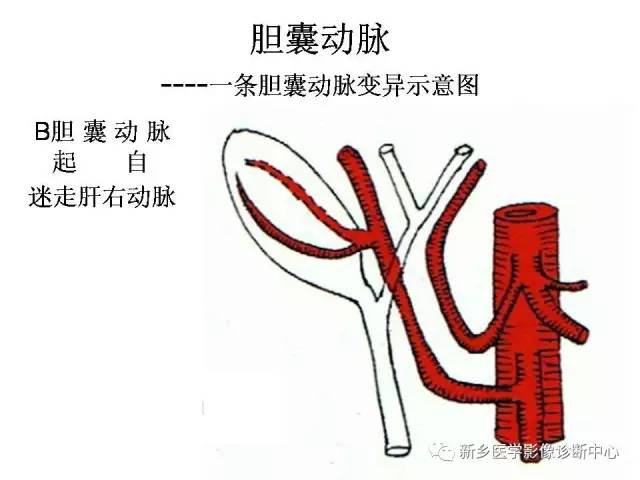 胆囊动脉的解剖和变异