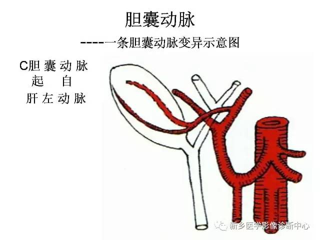 胆囊动脉的解剖和变异