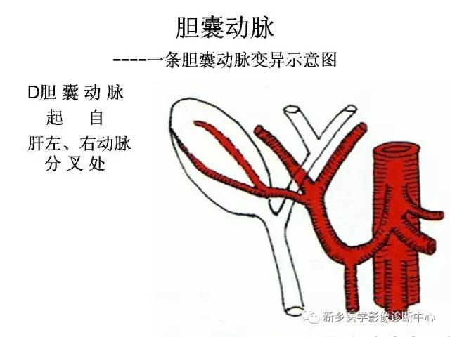 胆囊动脉的解剖和变异