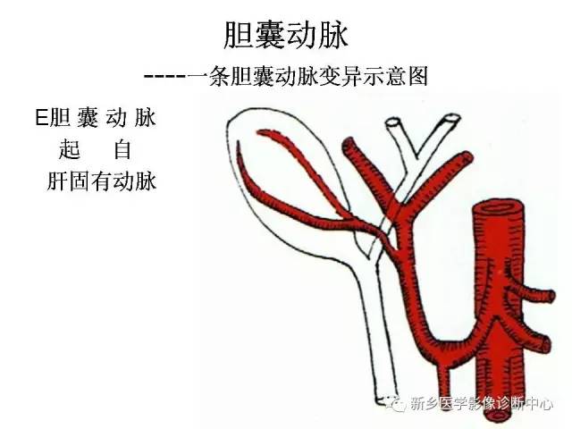 胆囊动脉的解剖和变异