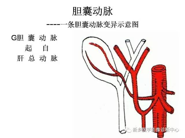 胆囊动脉的解剖和变异