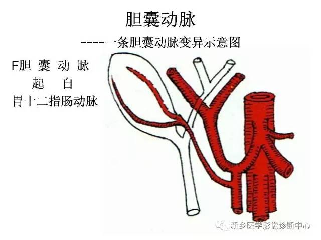 胆囊动脉的解剖和变异