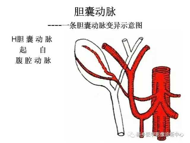 胆囊动脉的解剖和变异