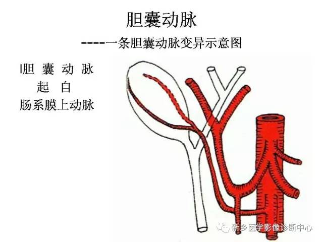 胆囊动脉的解剖和变异