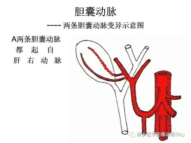 胆囊动脉的解剖和变异