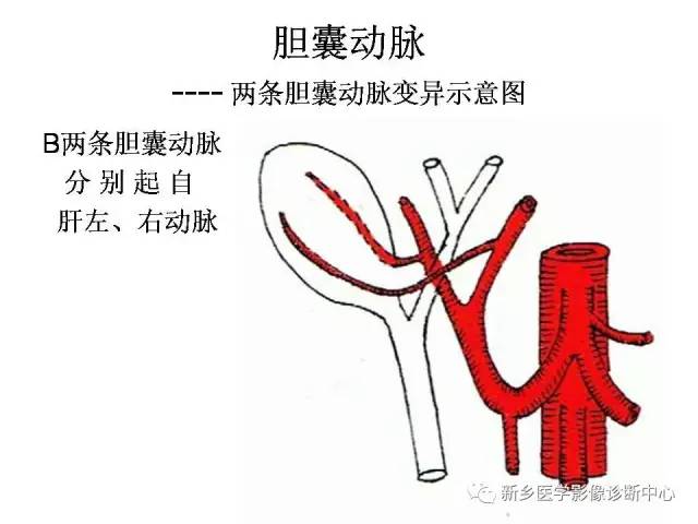 胆囊动脉的解剖和变异