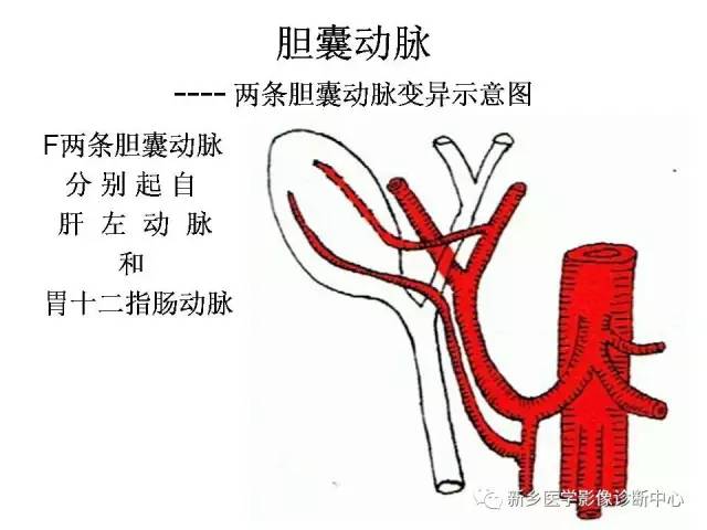 胆囊动脉的解剖和变异