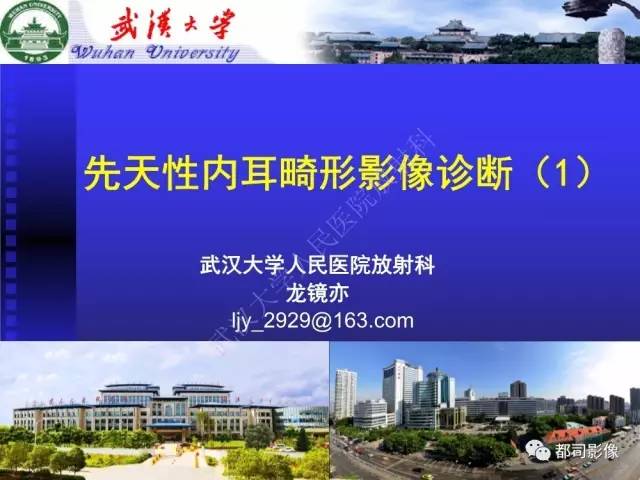 【PPT】先天性内耳畸形影像诊断