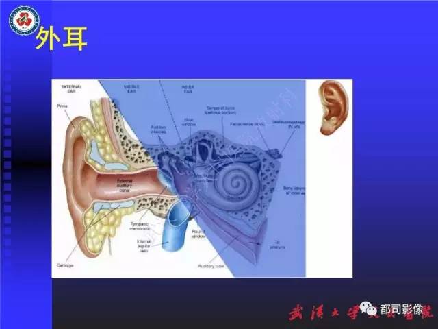 【PPT】先天性内耳畸形影像诊断