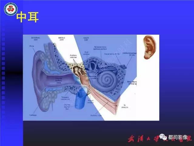 【PPT】先天性内耳畸形影像诊断
